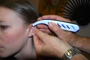 Ear Acupuncture Ear Acupuncture